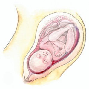 terhesség derékfájás harmadik trimeszter)