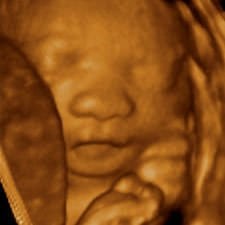 Veszélyeztetett terhesség: minden, amit tudni érdemes