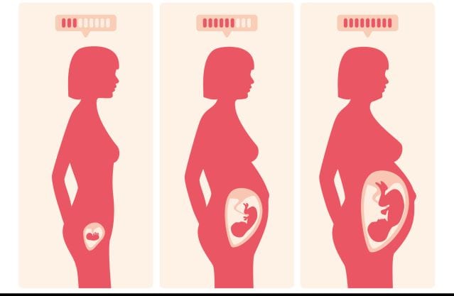 Hogyan kezelhető a terhességi inkontinencia?